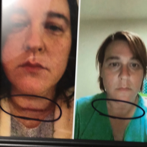 ❤️🩹BEST IN BEAUTY PICK!❤️🩹🛍MIRACLE HEALING BALM👌❤️👍—SALE!!$$!! - Picture 11 of 16